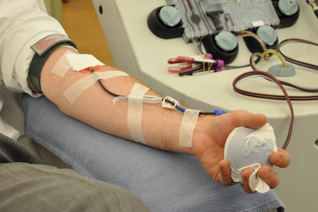 A donor's arm connected to a machine that will separate blood components into red cells, plasma, and platelets